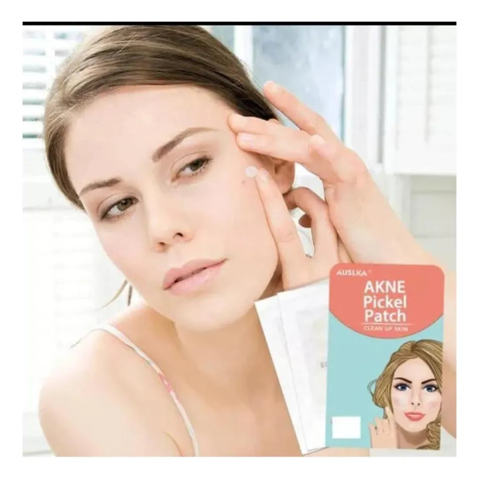 Parche acne 120 u