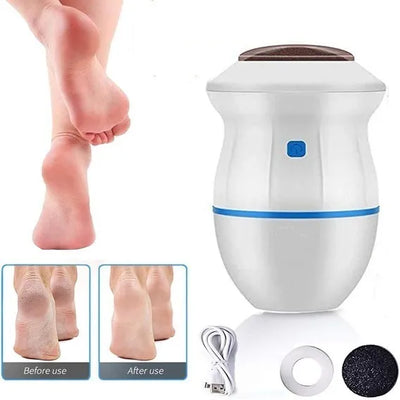 ELIMINADOR DE CALLOS GLOBO